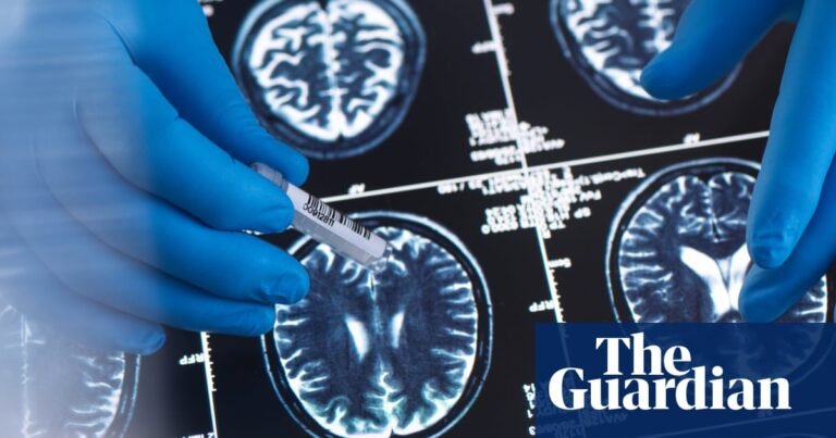 Optimists share similar brain patterns when thinking about the future, scans show | Psychology