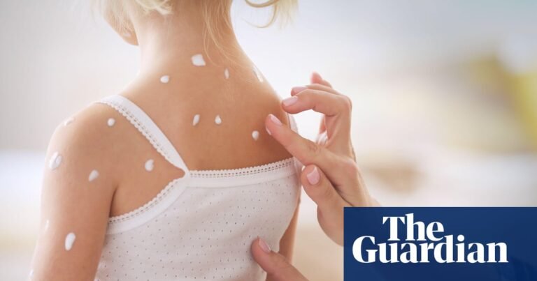 Sight of someone potentially infectious causes immune response, research suggests | Immunology Sight of someone potentially infectious causes immune response, research suggests | Immunology