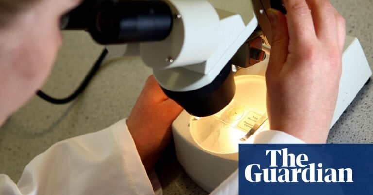 Women over 65 still at risk from cancer from HPV and should be offered cervical screening – study | Cervical cancer