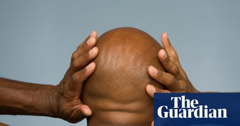 Learning to live with the torture of tinnitus | Deafness and hearing loss