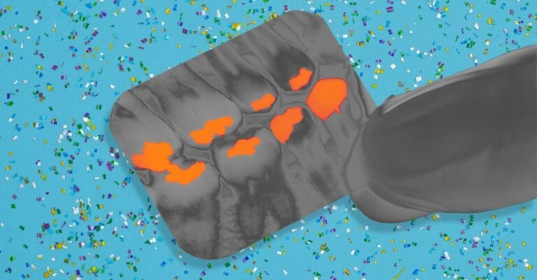 Modern Dentistry Is a Microplastic Minefield Modern Dentistry Is a Microplastic Minefield