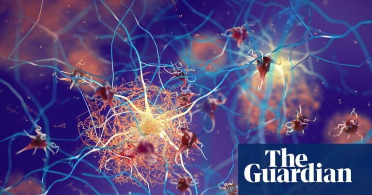 Is there hope on the horizon for patients with Alzheimer’s? – podcast | Science Is there hope on the horizon for patients with Alzheimer’s? – podcast | Science
