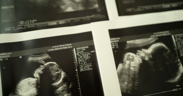 NIH Launches New Multimillion-Dollar Stillbirth Prevention Effort — ProPublica