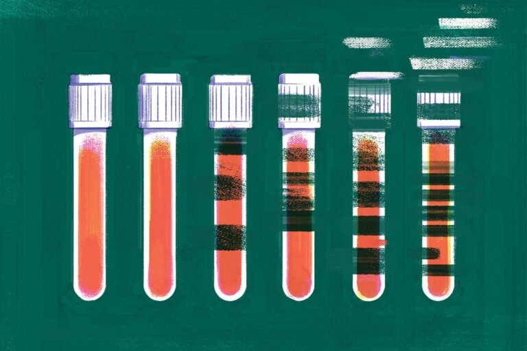 New Alzheimer’s Blood Tests Promise Early Detection but No Clear Path Forward