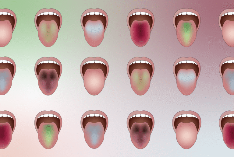 AI Scans Tongue Color to Predict Diseases AI Scans Tongue Color to Predict Diseases