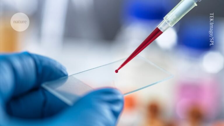 First proposed blood test for chronic fatigue syndrome: what scientists think