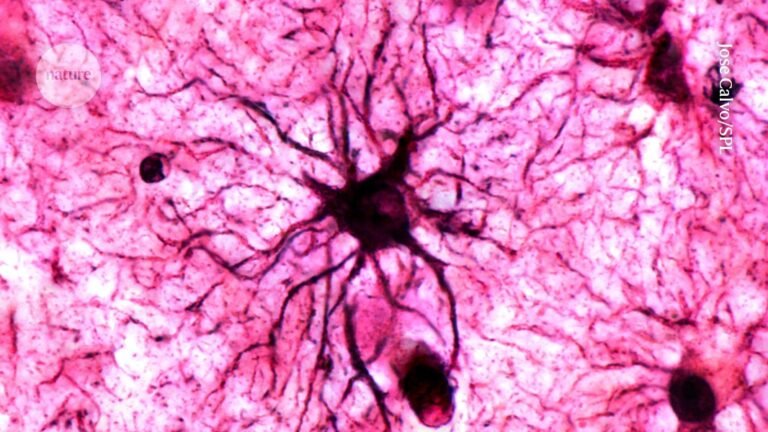 How emotional memories are engraved on the brain, with surprising helper cells How emotional memories are engraved on the brain, with surprising helper cells