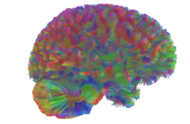 Scientists Identify Five Distinct Eras of Human Brain Aging Scientists Identify Five Distinct Eras of Human Brain Aging