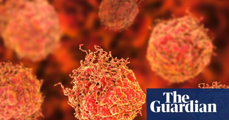 What is prostate cancer and how is it diagnosed in the UK? | Prostate cancer What is prostate cancer and how is it diagnosed in the UK? | Prostate cancer