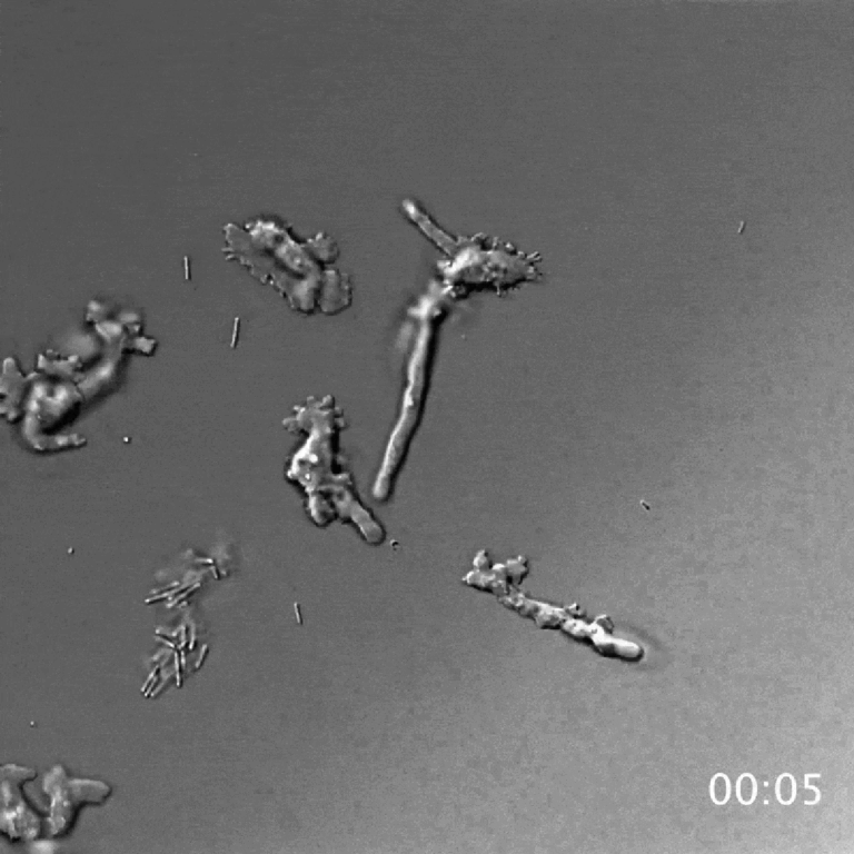 Extremophile ‘Fire Amoeba’ Pushes the Boundaries of Complex Life