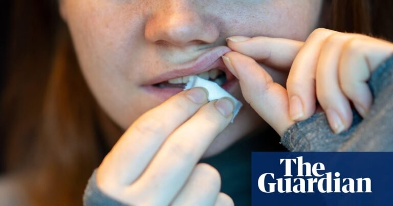 One in eight of 14- to 17-year-olds in Great Britain say they have used nicotine pouches | Health