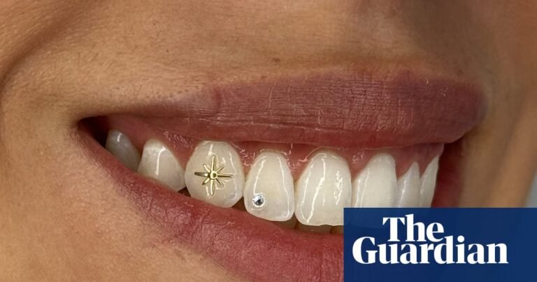 Young Australians are lining up for tooth gems. Are blinged grins harmless, or a dental disaster? | Australian fashion Young Australians are lining up for tooth gems. Are blinged grins harmless, or a dental disaster? | Australian fashion