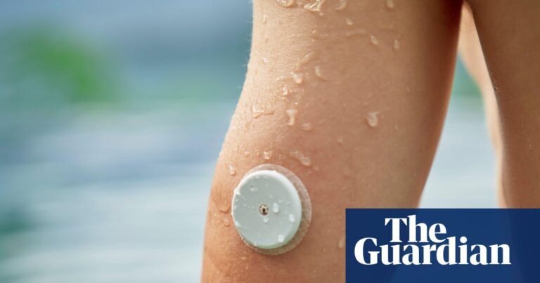 Ethnic minorities in England less likely to have access to diabetes tech – study | Diabetes