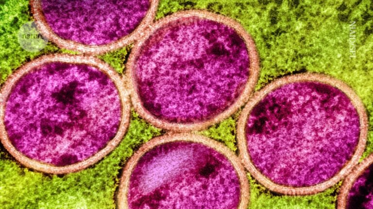 Will mpox go global again? Research shows it’s evolving in curious ways Will mpox go global again? Research shows it's evolving in curious ways
