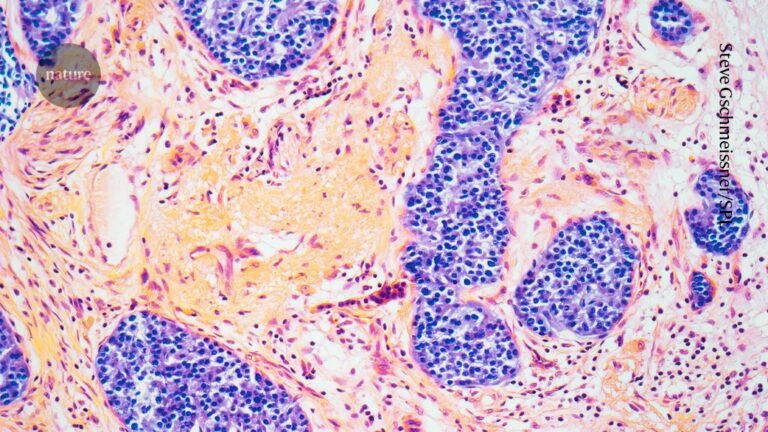 Are obesity drugs causing a severe complication? What the science says