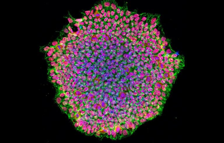 First-of-a-kind stem-cell therapies set for approval in Japan