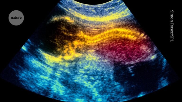 World-first stem-cell therapy shows promise for treating spina bifida in the womb World-first stem-cell therapy shows promise for treating spina bifida in the womb