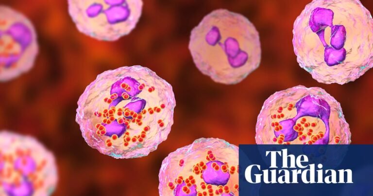 Experts consider expanding meningitis vaccine eligibility after Kent outbreak | Meningitis Experts consider expanding meningitis vaccine eligibility after Kent outbreak | Meningitis