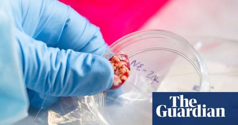 CDC temporarily halts testing for several infectious diseases amid staffing shortages | Trump administration