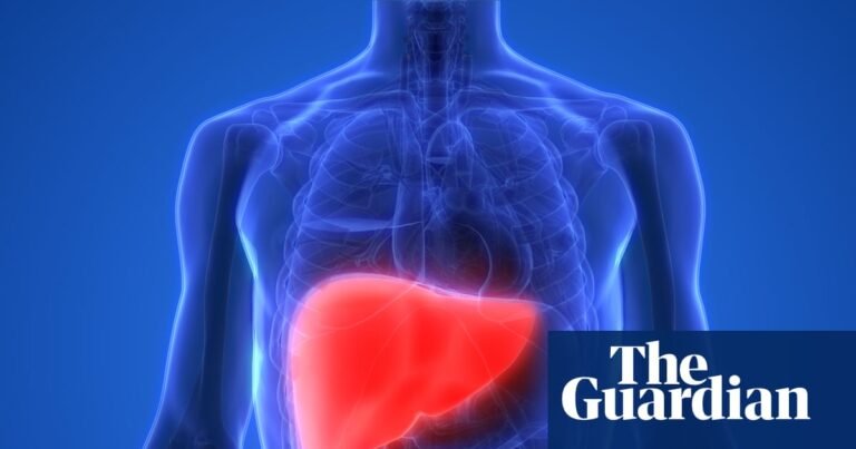 Raise tax on alcohol and junk food to cut deaths from liver disease, experts say | Health