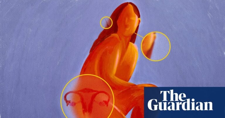 Can a name change transform PCOS outcomes for women? – podcast | Polyendocrine metabolic ovarian syndrome (PMOS) Can a name change transform PCOS outcomes for women? – podcast | Polyendocrine metabolic ovarian syndrome (PMOS)