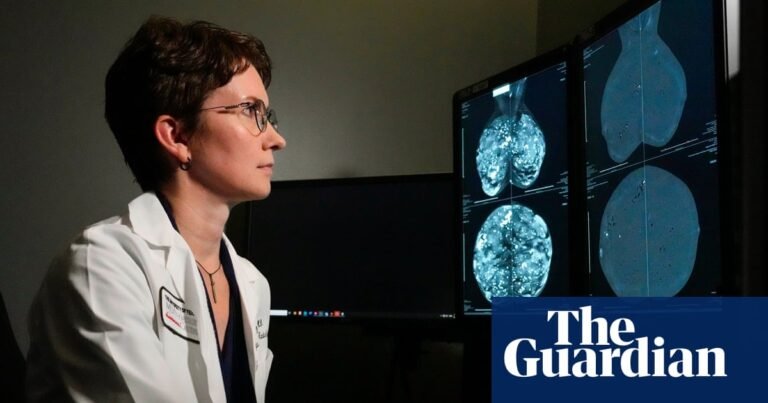 Groundbreaking genomic test could spare millions of breast cancer patients chemotherapy | Breast cancer