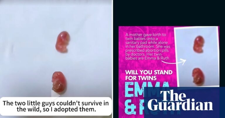 Image of ‘twin babies’ used by anti-abortion activist appears to show sugar gliders | Abortion Image of ‘twin babies’ used by anti-abortion activist appears to show sugar gliders | Abortion