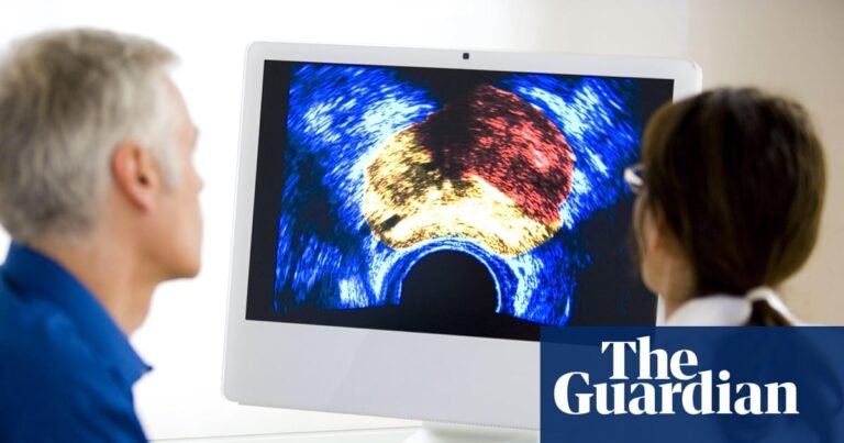 Most UK men should not be offered prostate cancer screening, experts say | Prostate cancer Most UK men should not be offered prostate cancer screening, experts say | Prostate cancer