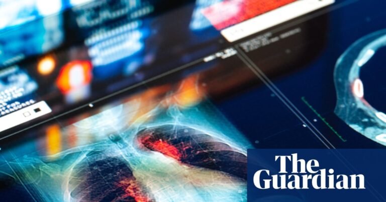 Doctors and NHS could be sued for mistakes made by AI tools, report warns | NHS Doctors and NHS could be sued for mistakes made by AI tools, report warns | NHS