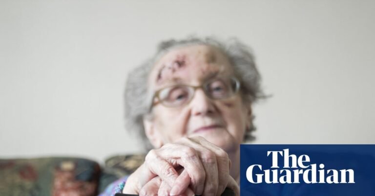 GPs in England too ‘overloaded’ to help older people at risk of falling, say MPs | Older people