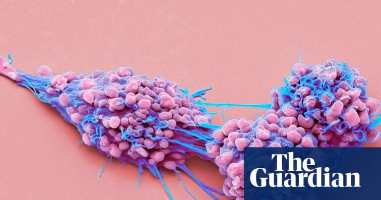 Life-prolonging drug for advanced ovarian cancer gets go-ahead in England | Ovarian cancer
