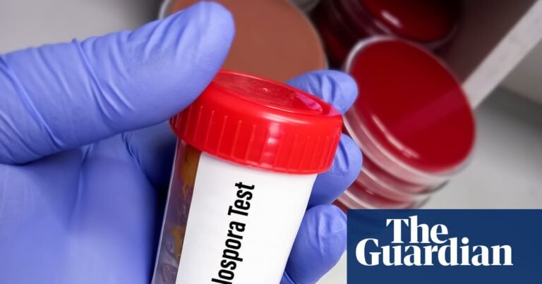 Trump’s deep public health cuts hinder response to record US cyclosporiasis outbreak | Health Trump’s deep public health cuts hinder response to record US cyclosporiasis outbreak | Health