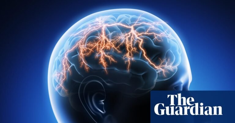 Why migraines are often undiagnosed | Health
