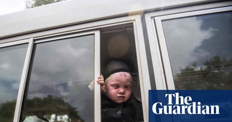 ‘I was devastated’: the Nigerian with albinism deported under Trump’s asylum crackdown | Global development ‘I was devastated’: the Nigerian with albinism deported under Trump’s asylum crackdown | Global development