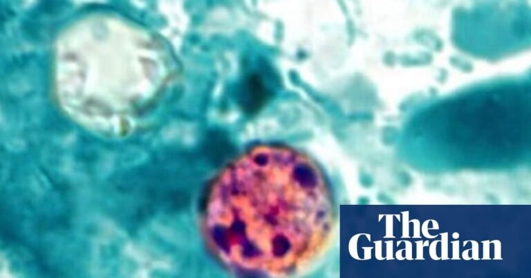Two people have died amid US cyclosporiasis outbreak, Michigan officials say | Michigan Two people have died amid US cyclosporiasis outbreak, Michigan officials say | Michigan