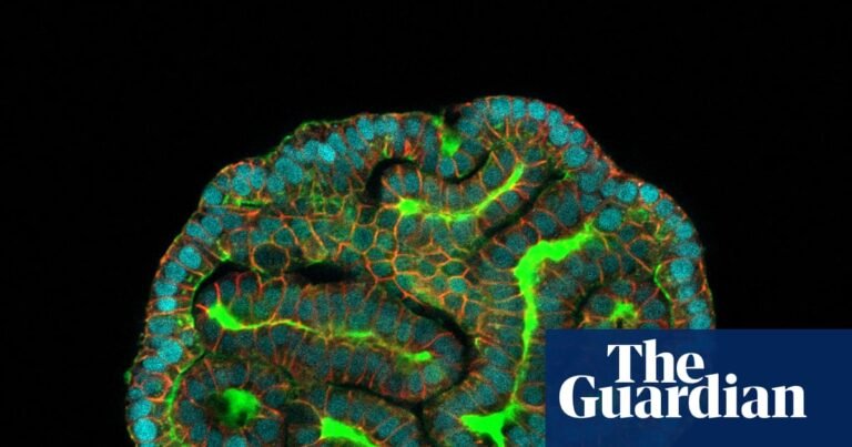 ‘A mouse can’t tell us what works’: UK scientists to grow miniature human organs for drug testing | Medical research
