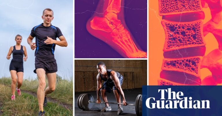 ‘I spent a week crying. I’ve never had an injury in my life!’ Why do so many fitness fans end up needing surgery? | Health & wellbeing