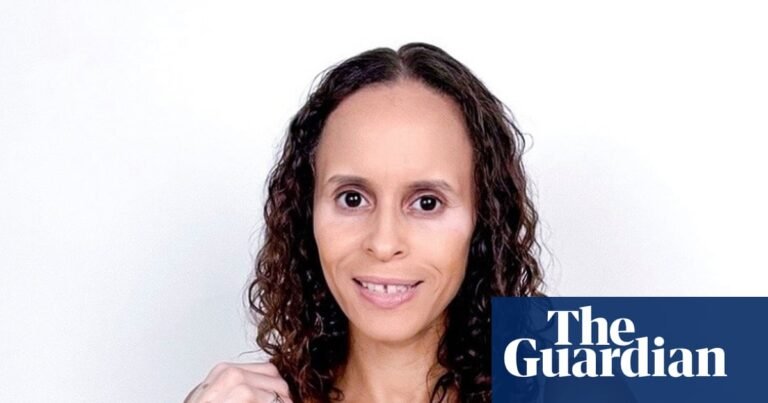 A moment that changed me: I felt hugely self conscious about my skin – until I had a revelation | Comedy A moment that changed me: I felt hugely self conscious about my skin - until I had a revelation | Comedy