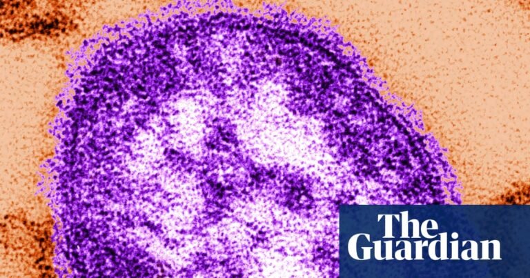 Six-week-old child in Pennsylvania died from measles, coroner says | Pennsylvania Six-week-old child in Pennsylvania died from measles, coroner says | Pennsylvania