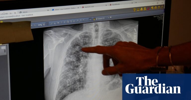 We know how to prevent black lung, so why are workers still dying? | US news